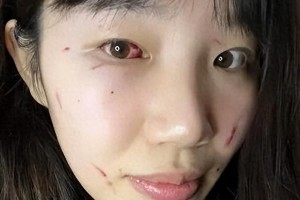 WCBA赛场乱象：外援肘击致伤 裁判争议不断
